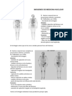 Imágenes de Medicina Nuclear