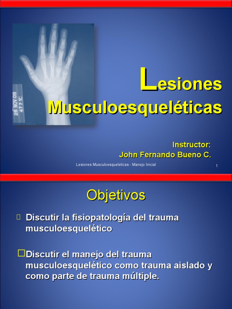 Lesiones Musculoesqueleticas | Lesión | Anatomía humana