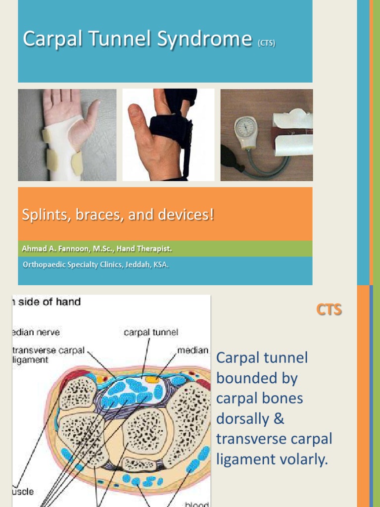 Carpal Tunnel Syndrome Splints