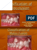 Classification of Malocclusion Project MGM Dental