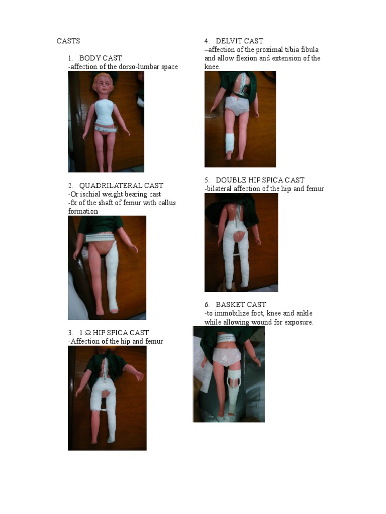 Overview of Orthopedic Casts and Traction | PDF | Human Leg | Hip