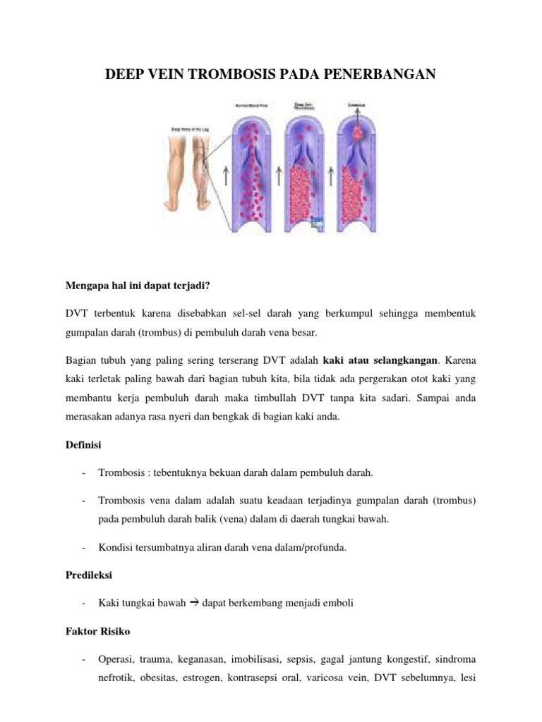 Risiko DVT pada Penerbangan Jauh | PDF | Sains & Matematika