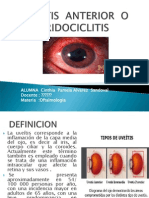 Uveitis Anterior o Iridociclitis