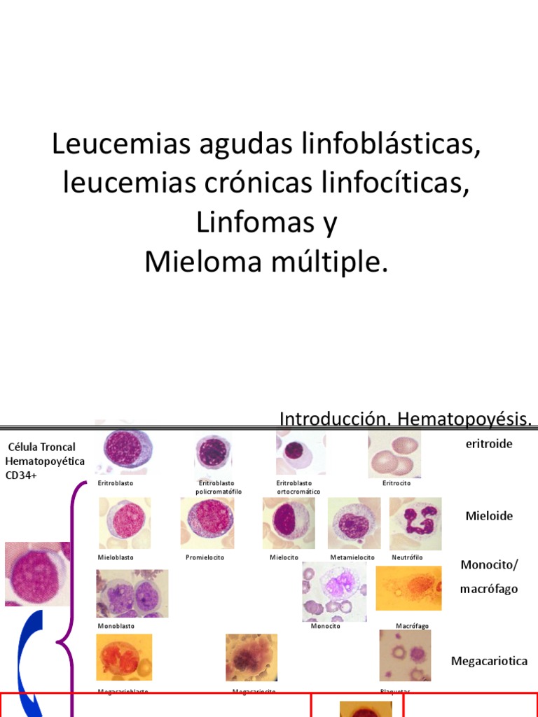 leucemias-descargar-gratis-pdf-hematopoyesis-leucemia