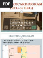 Electrocardiogram (ECG or EKG) : Danilyn R. Cenita Paula M. Paulo