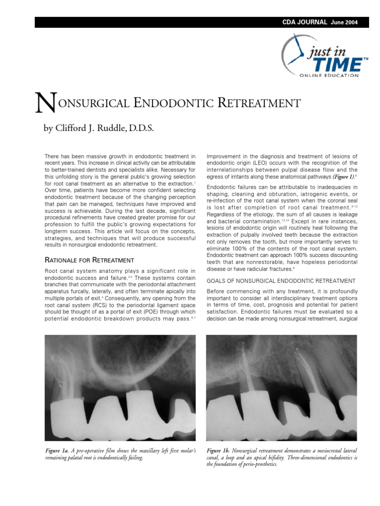 Endodontic Retreatment PDF Mouth Dentistry