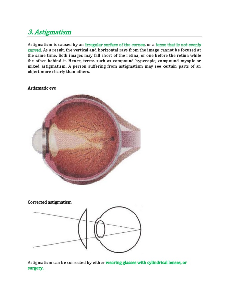Astigmatism | PDF | Eye | Ophthalmology