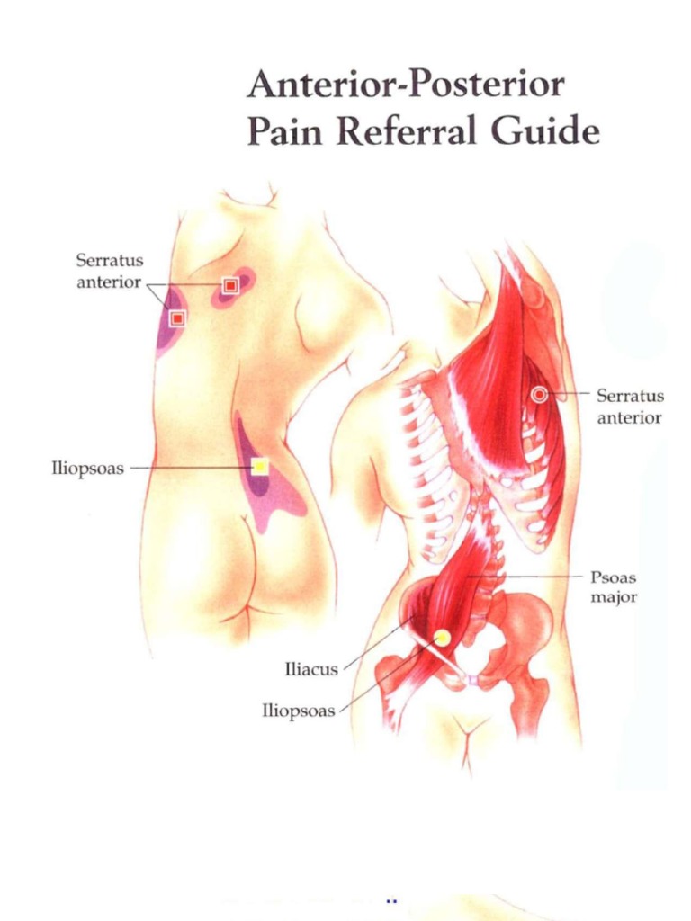 Trigger Point Colour Maps | PDF | Travel | Foreign Language Studies