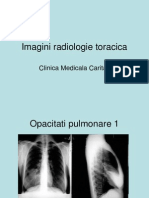 Imagini radiologie toracica