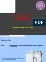 Tipos de ganchos ortodóncicos