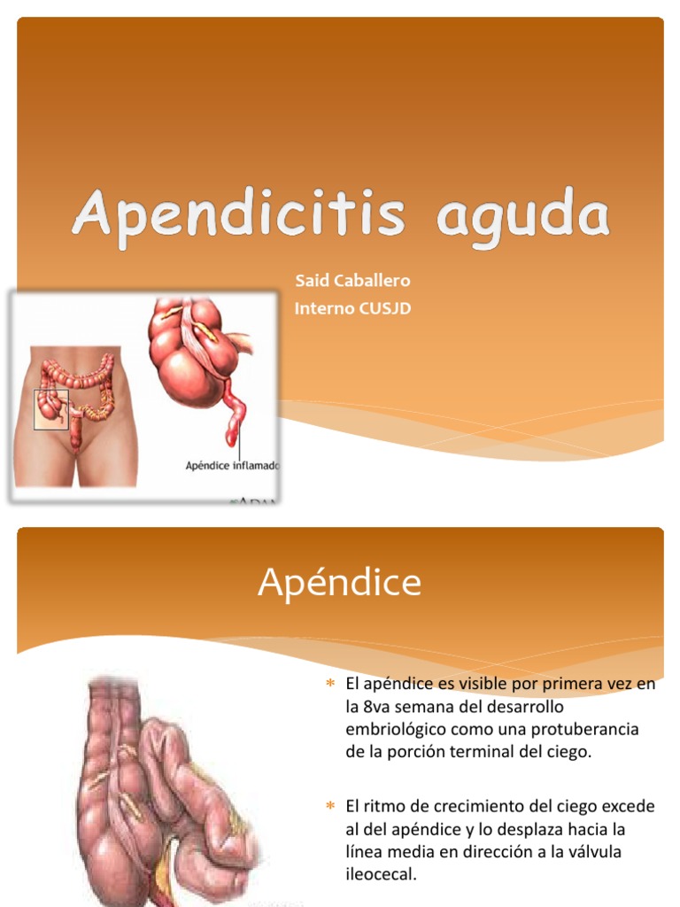 Apendicitis DR Saidoc Complete | PDF | Gastroenterología ...