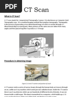 What Is CT Scan?