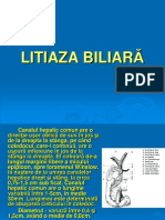 Litiaza biliara