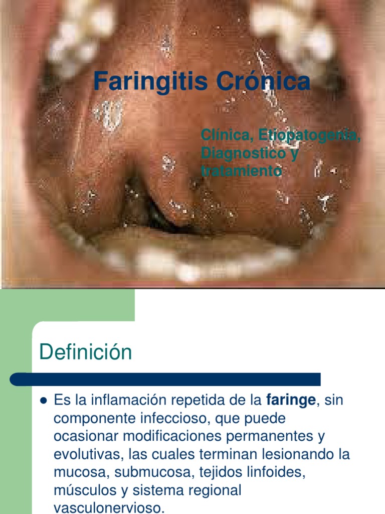 Faringitis Crónica | PDF | Salud y bienestar