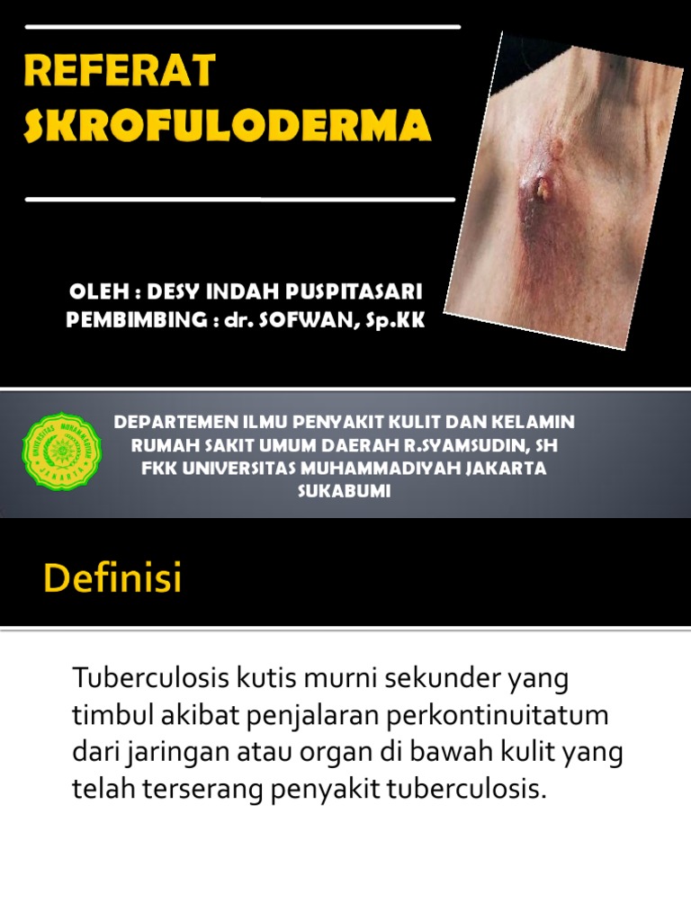 Referat Tb Kulit