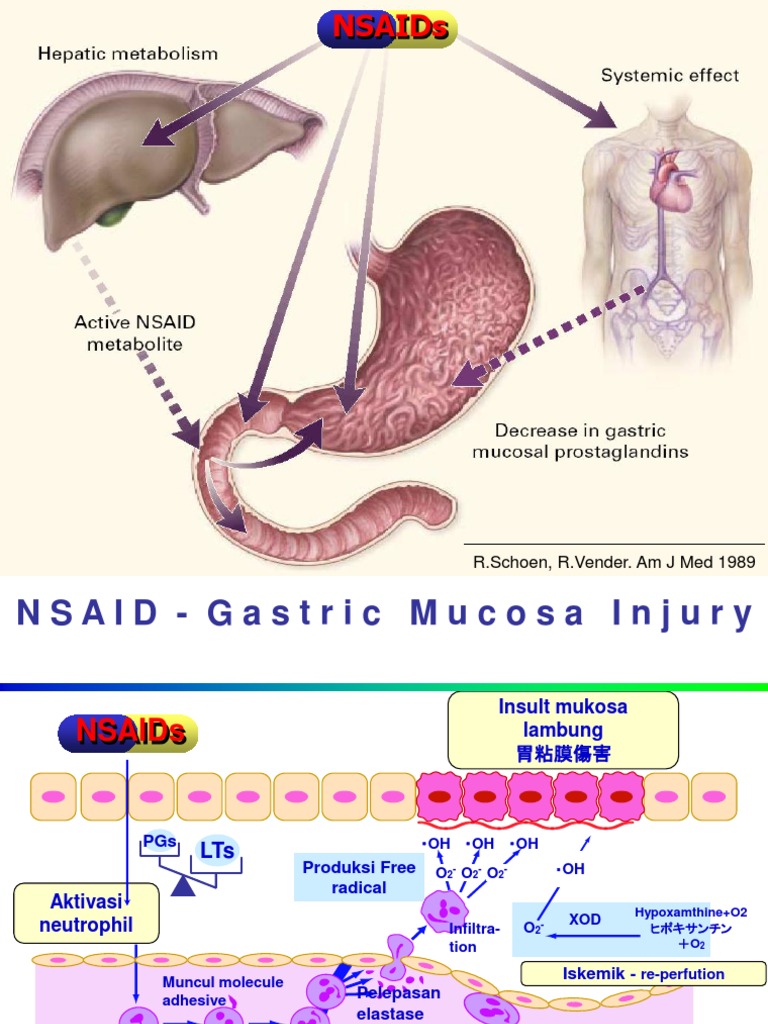 NSAIDs and Gastric Mucosal Injury | PDF | Science & Mathematics