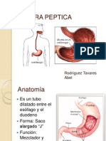 Ulcera peptica: anatomía, causas, complicaciones y tratamiento