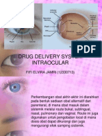 DDS Intraocular