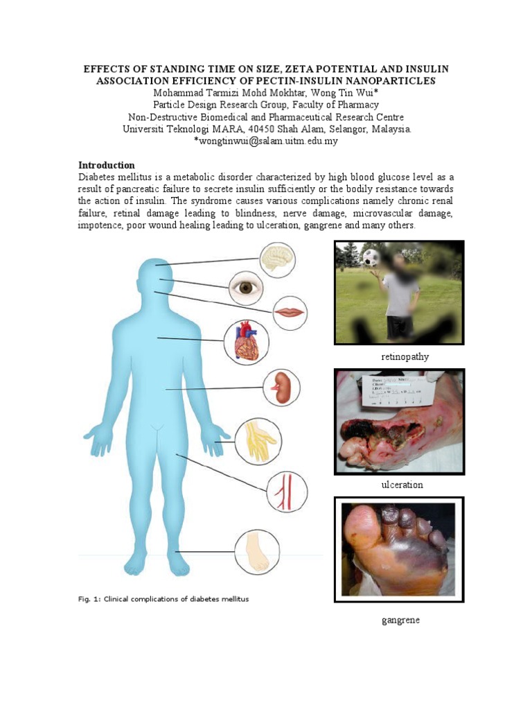 Effects of Standing Time On Size, Zeta Potential and Insulin
