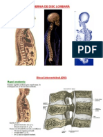 herniile de disc