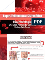 Lupus Eritematoso