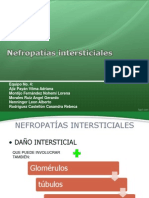 Nefropatias Intersticiales Agudas