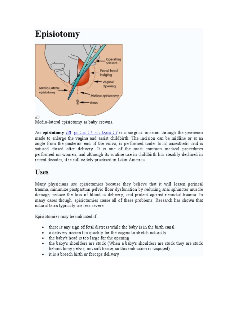 Episiotomy Childbirth Women's Health