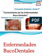 Enfermedades Bucales