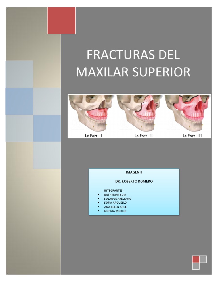 Fracturas del Maxilar Superior: Clasificación y Anatomía | PDF | Cráneo ...