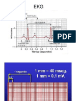 ECG                                                                                                