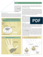 Carpal Tunnel Syndrome: What Is It?