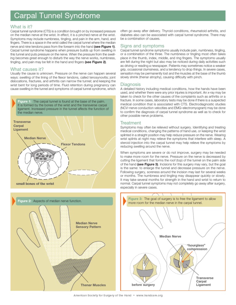Understanding Carpal Tunnel Syndrome | PDF | Carpal Tunnel Syndrome | Hand