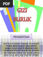 Download Ppt Gizi Buruk by Hendry Fortunsius SN121472697 doc pdf