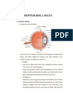 Ruptur Bola Mata Jadii