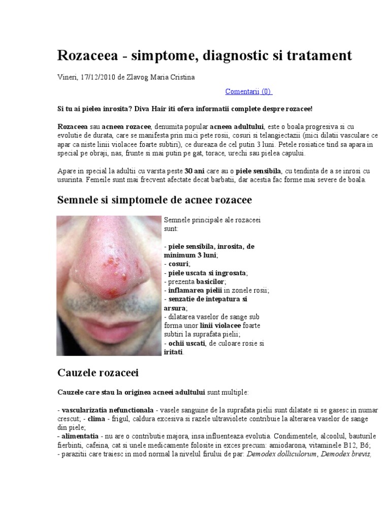 Acneea Rozaceea Simptome Diagnostic Tratament