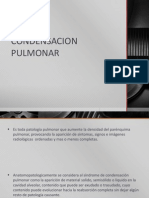 Condensacion Pulmonar