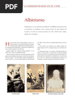 Albinismo en El Cine