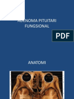 Adenoma Pituitari Fungsional