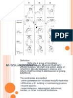 Muscular Dystrophy