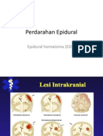 Perdarahan Epidural / Epidural Hematome (Suaida FK-UMM 2009)