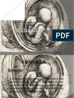 Cesareac PDF 100820004752 Phpapp01