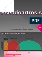 8. Pseudoartrosis