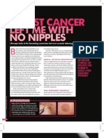 Breast Cancer Article - Lifescape Magazine