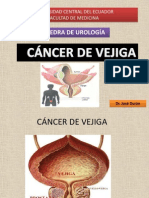 Cancer de Vejiga