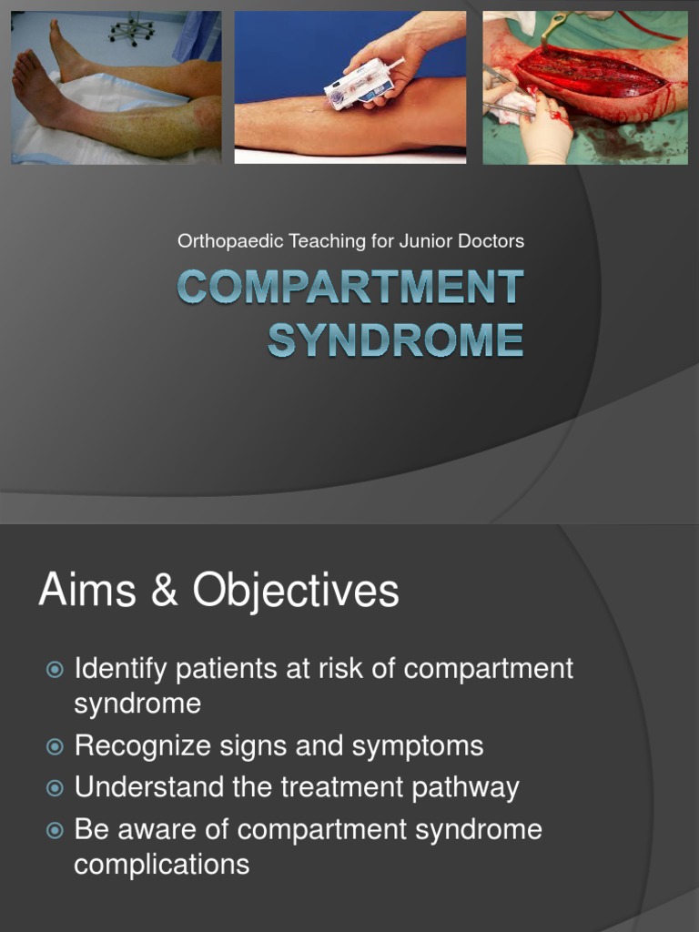 Compartment Syndrome: Signs and Treatment | PDF | Musculoskeletal ...