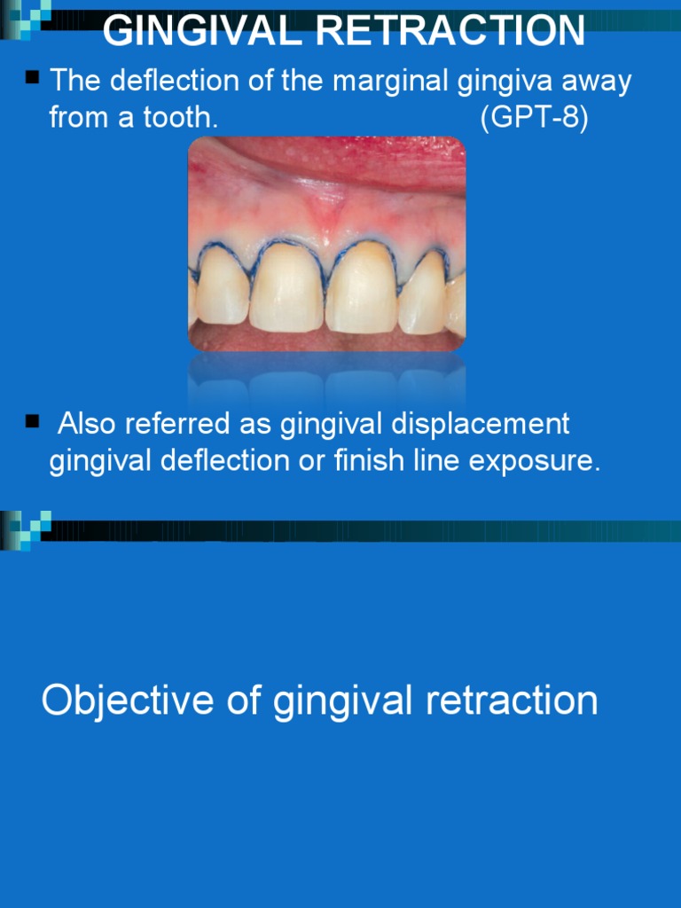 finish line Laser Surgery