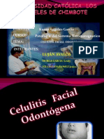 Celulitis Facial Odontógena