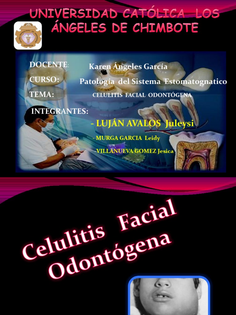 Celulitis Facial Odontógena | PDF | Diente humano | Infección