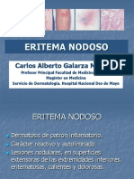 Eritema Nodoso