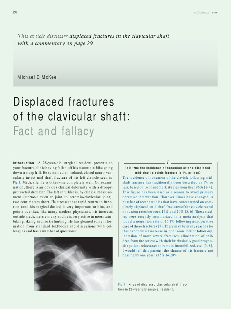 Clavicle Fracture | PDF | Surgery | Shoulder
